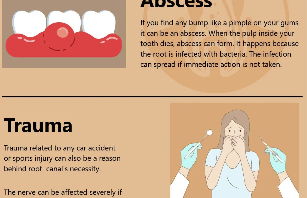 Root Canal Signs You Should Notice