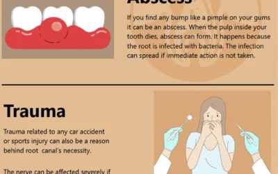 Root Canal Signs You Should Notice