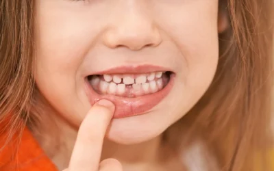 How to Correct a Small Teeth?