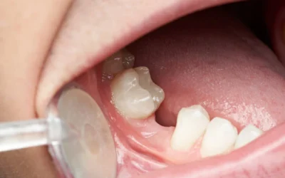 Thin Line Between General & Cosmetic Dentist
