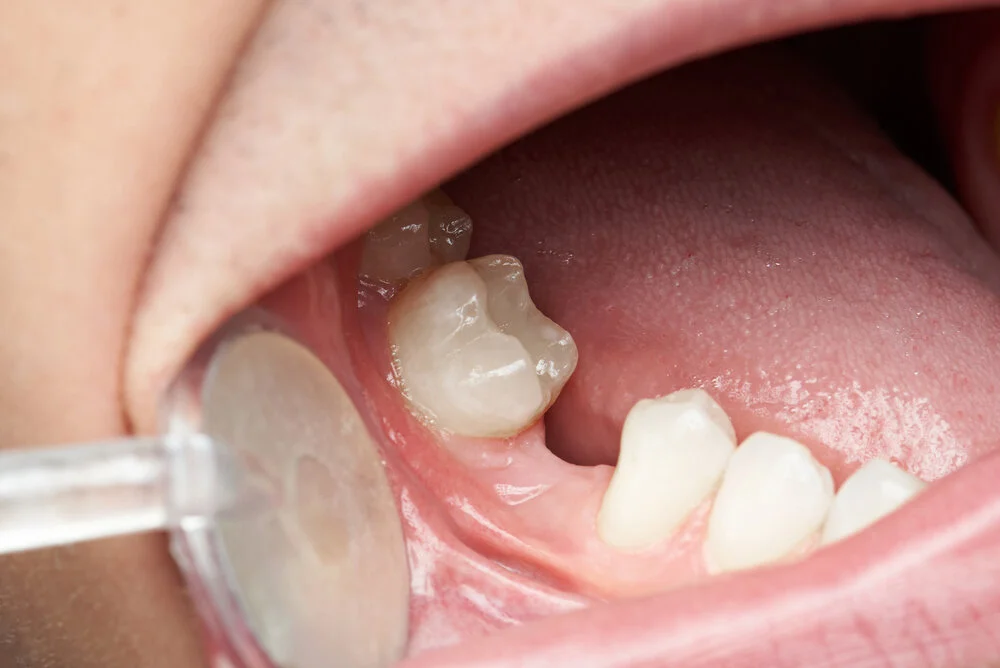 Thin Line Between General & Cosmetic Dentist