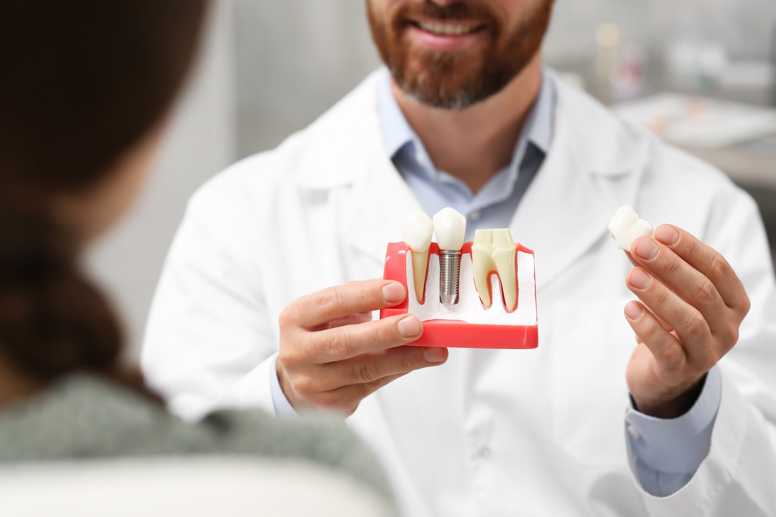Dental Implants