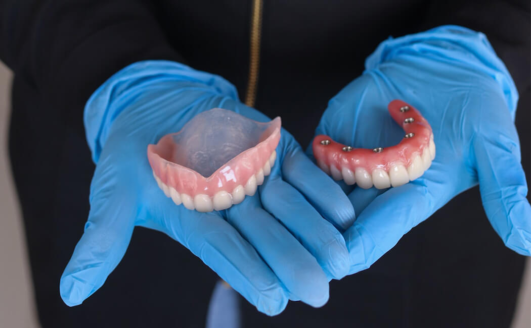 Implant-supported dentures