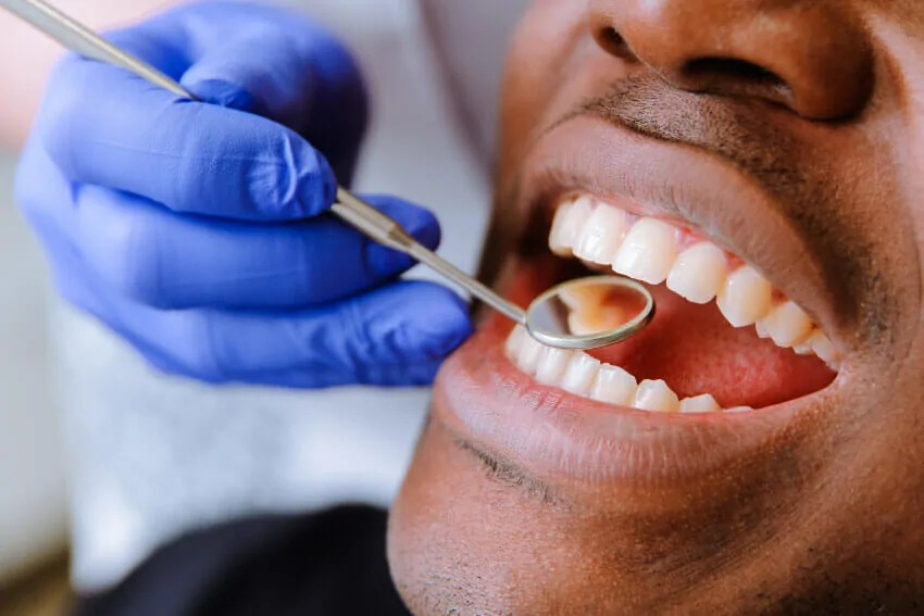 Natural-looking tooth-colored filling treatment
