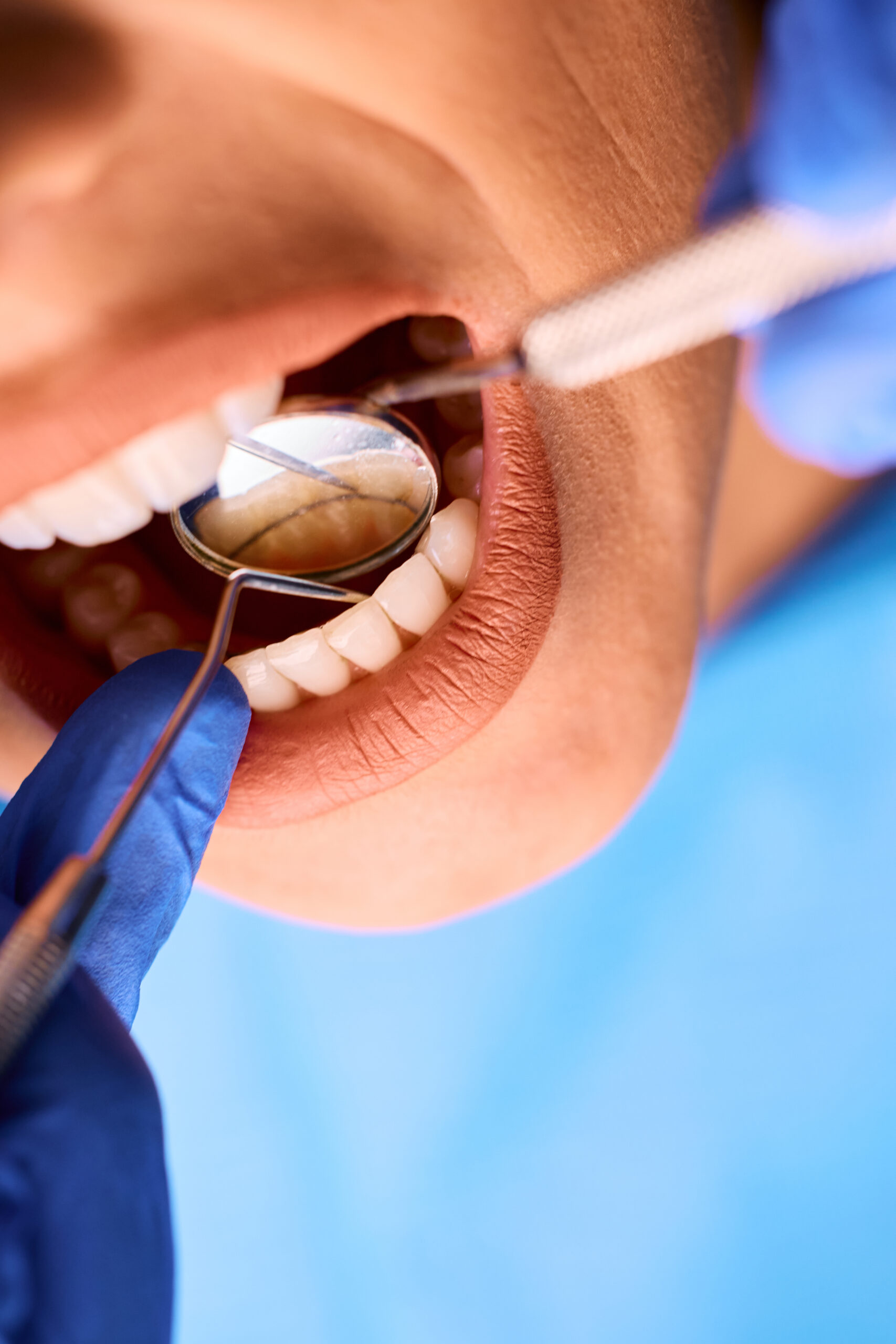 Restorative crowns and bridges care at Comprehensive Family Dentistry