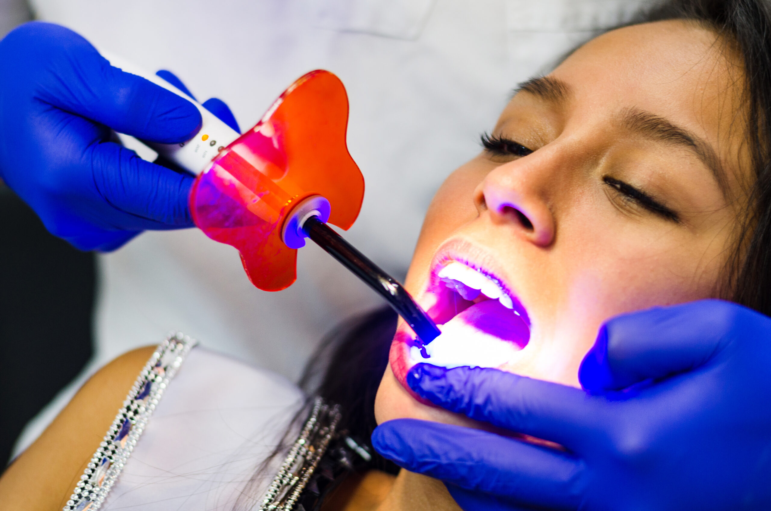 Personalized professional teeth whitening treatment