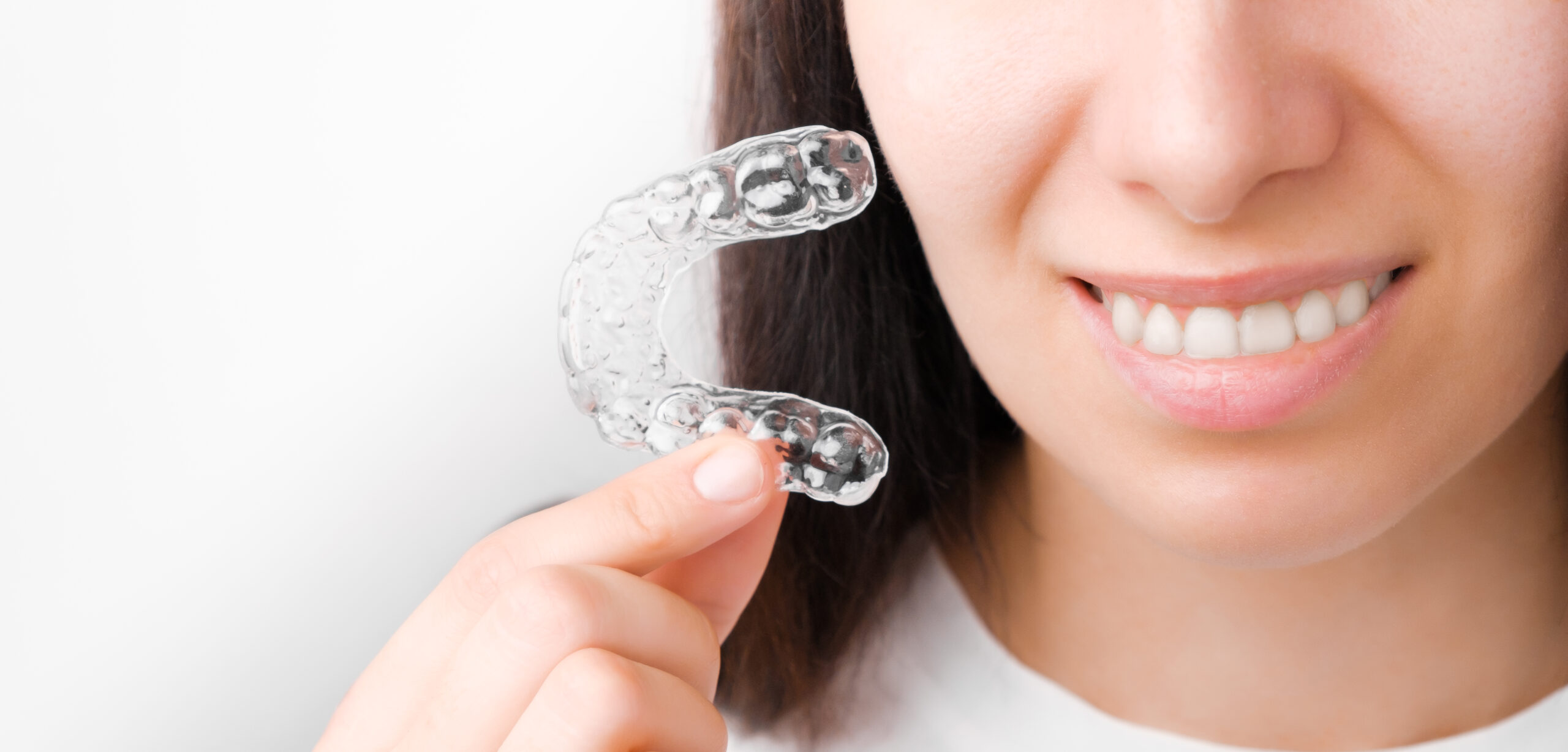 Custom take-home teeth whitening