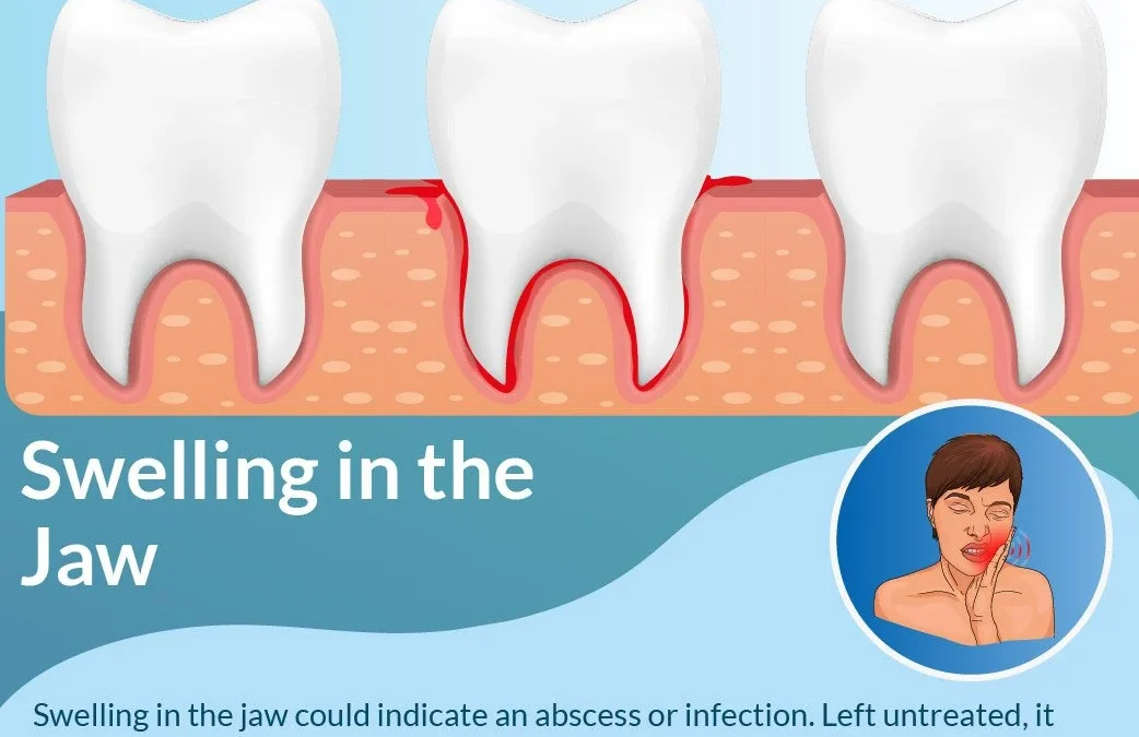 Emergency Dental care: Know The Most Obvious Signs- Infographic