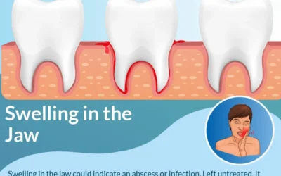 Emergency Dental care: Know The Most Obvious Signs- Infographic