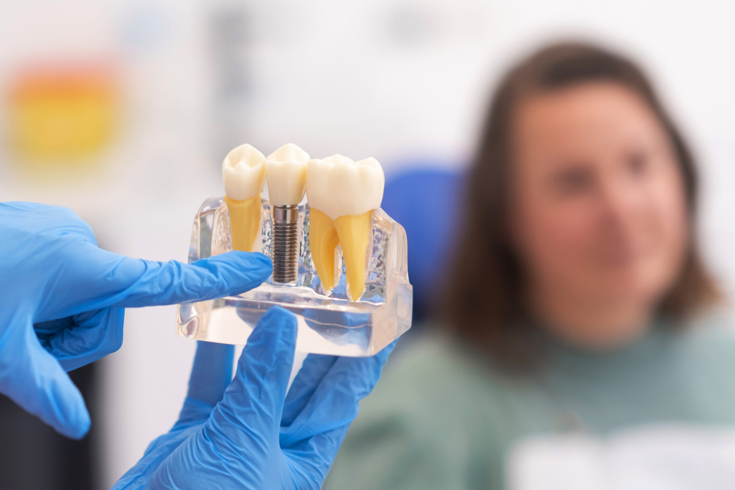 Dental implant model being used to explain treatment