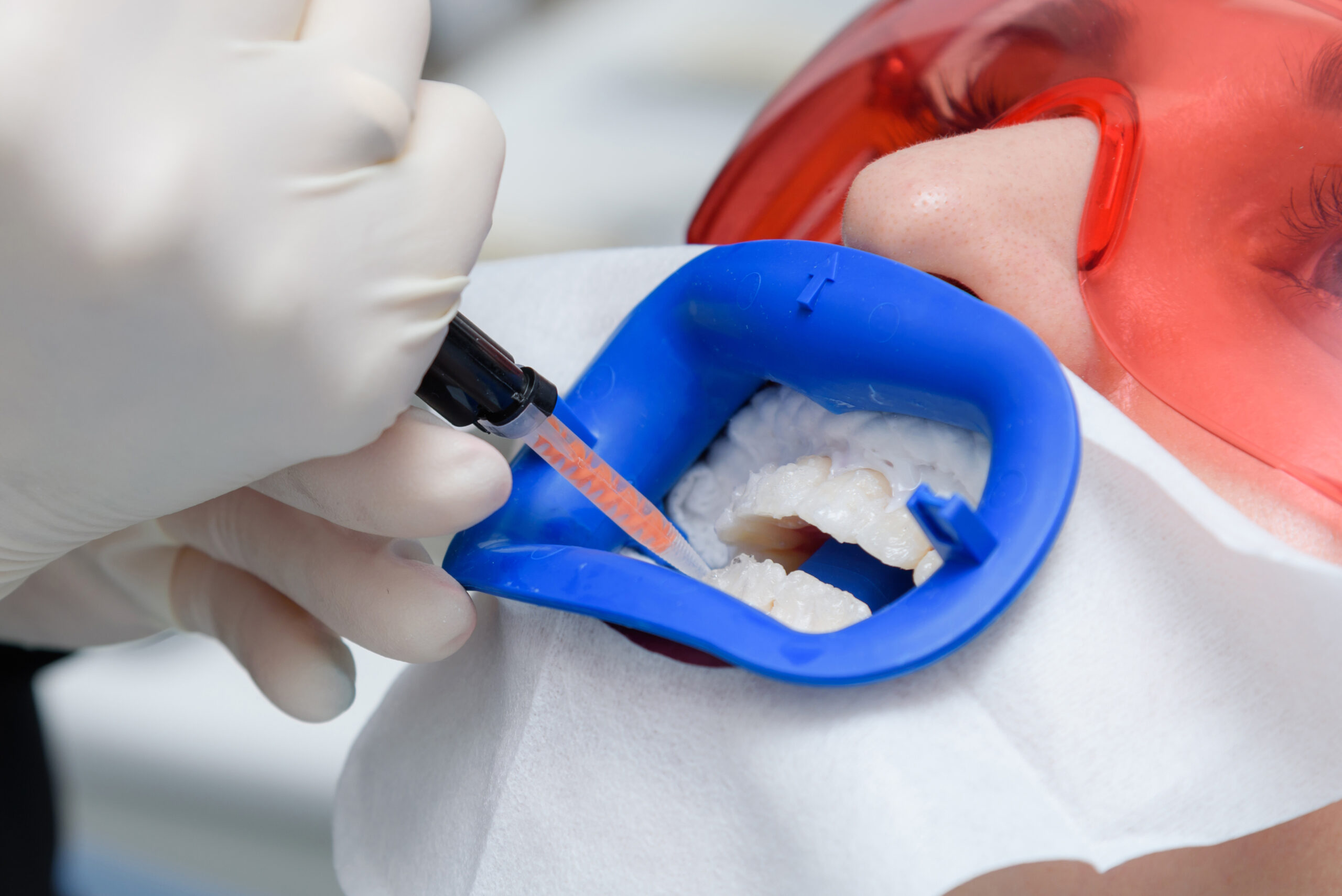 Other cosmetic dentistry treatment options