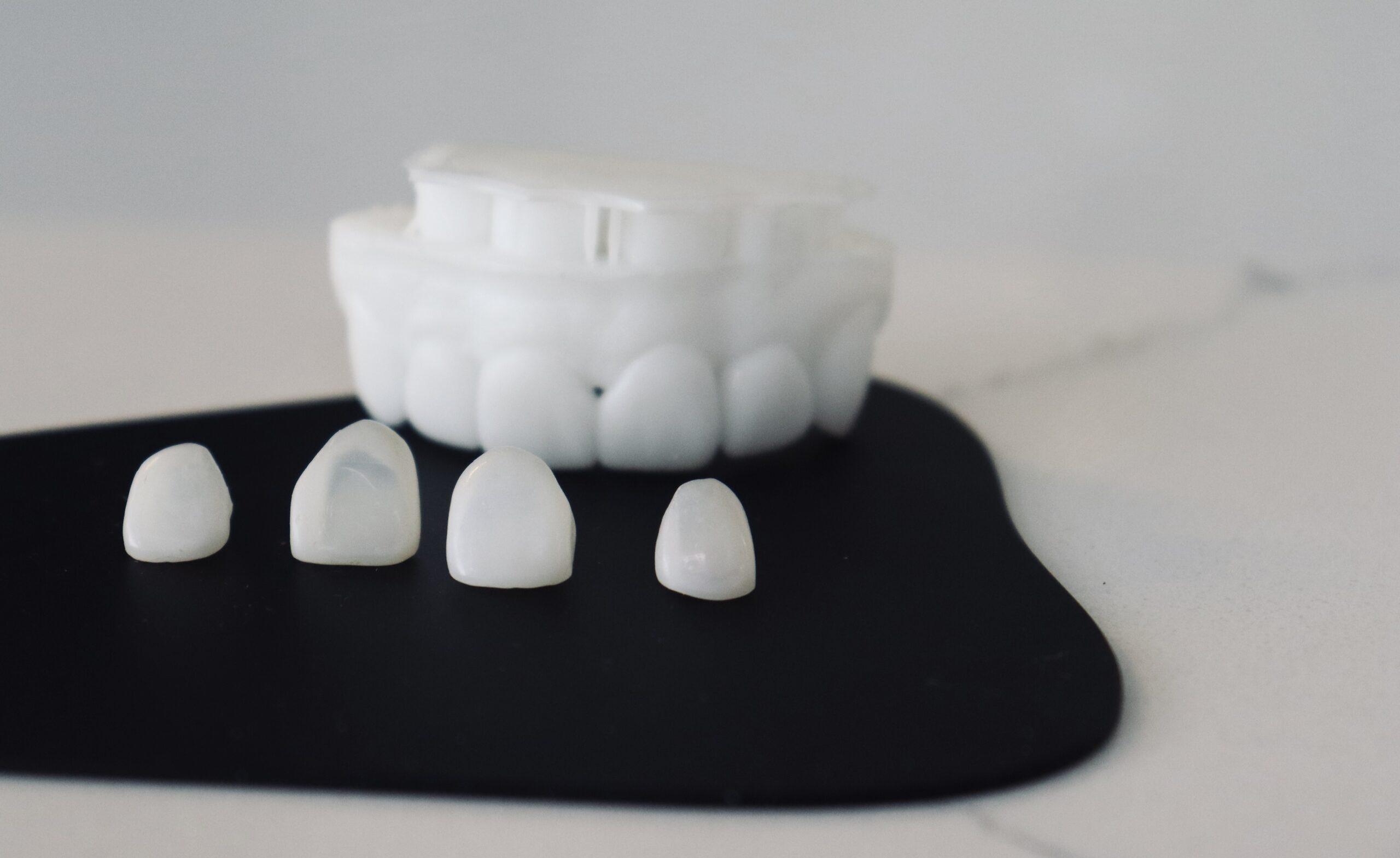 Porcelain Veneers
