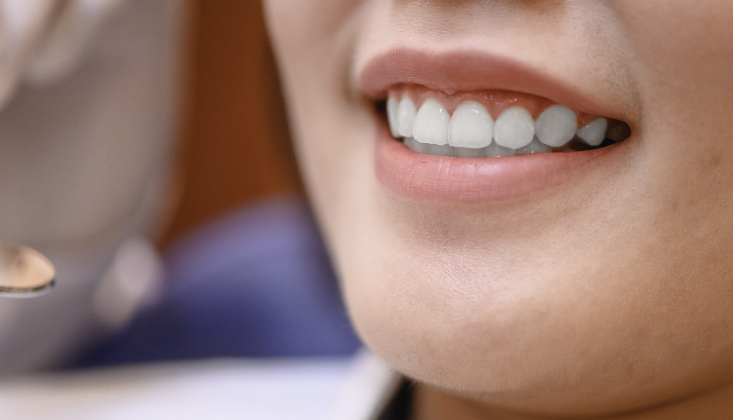 Professional teeth whitening for noticeably brighter results