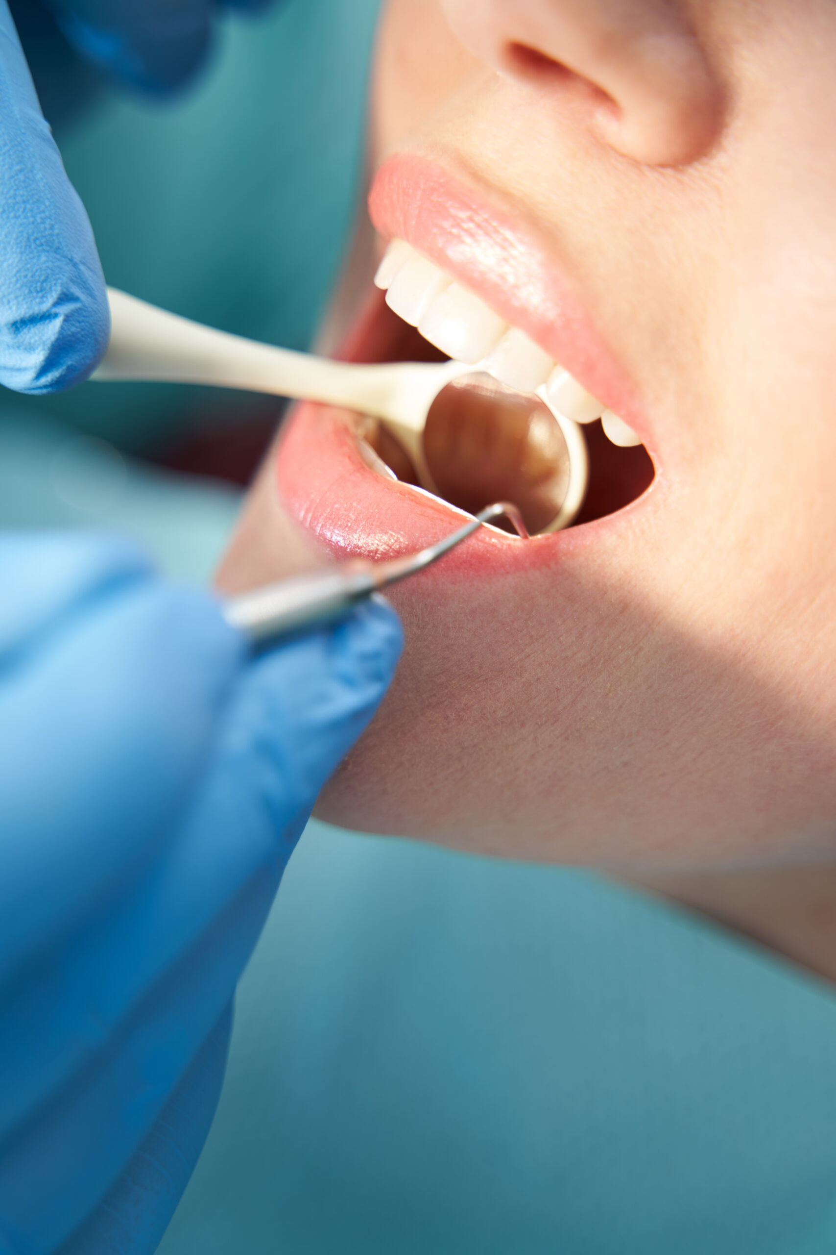 Comprehensive Family Dentistry restorative dental care