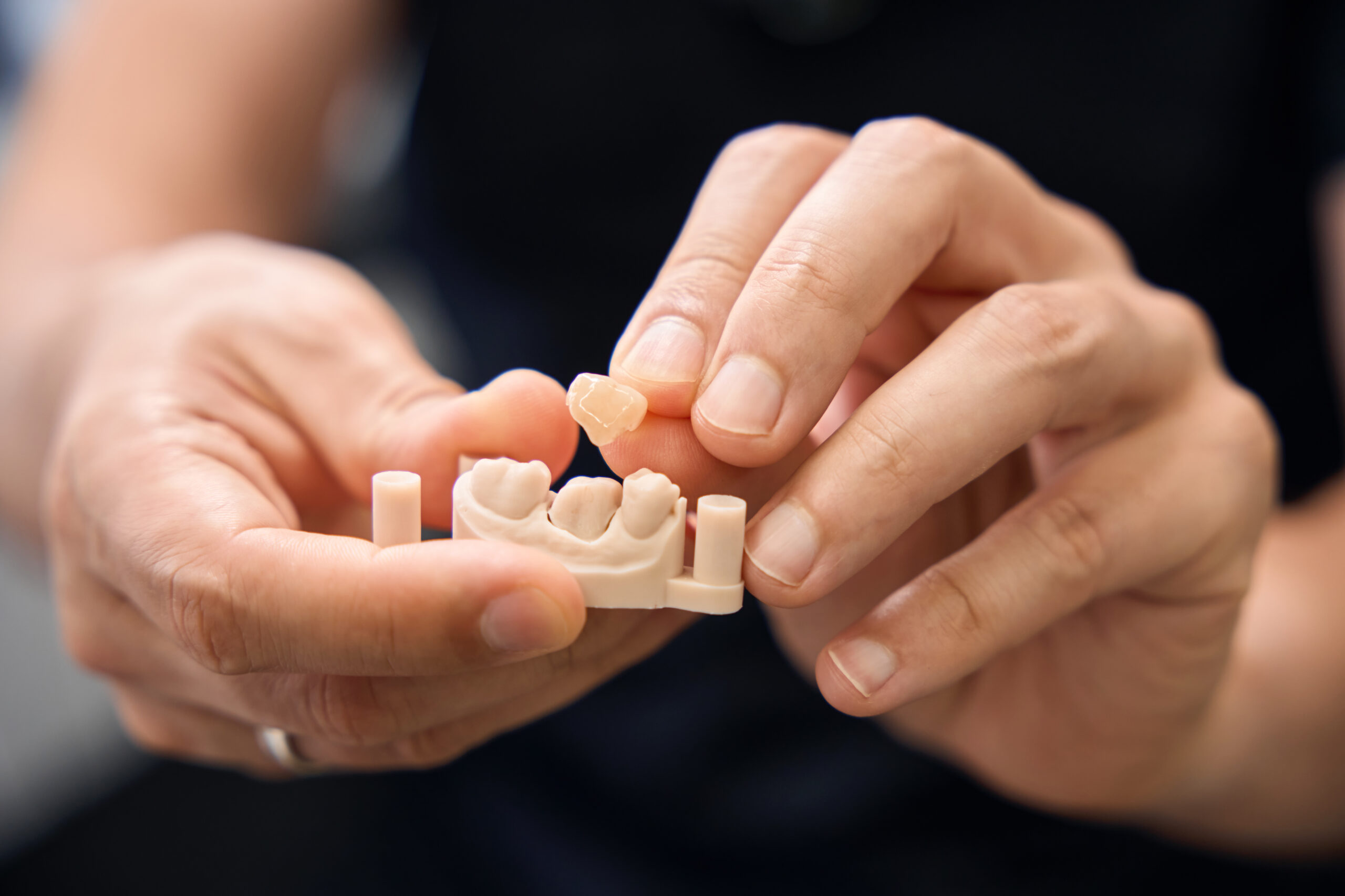 Placeholder image for partials and dentures at Comprehensive Family Dentistry