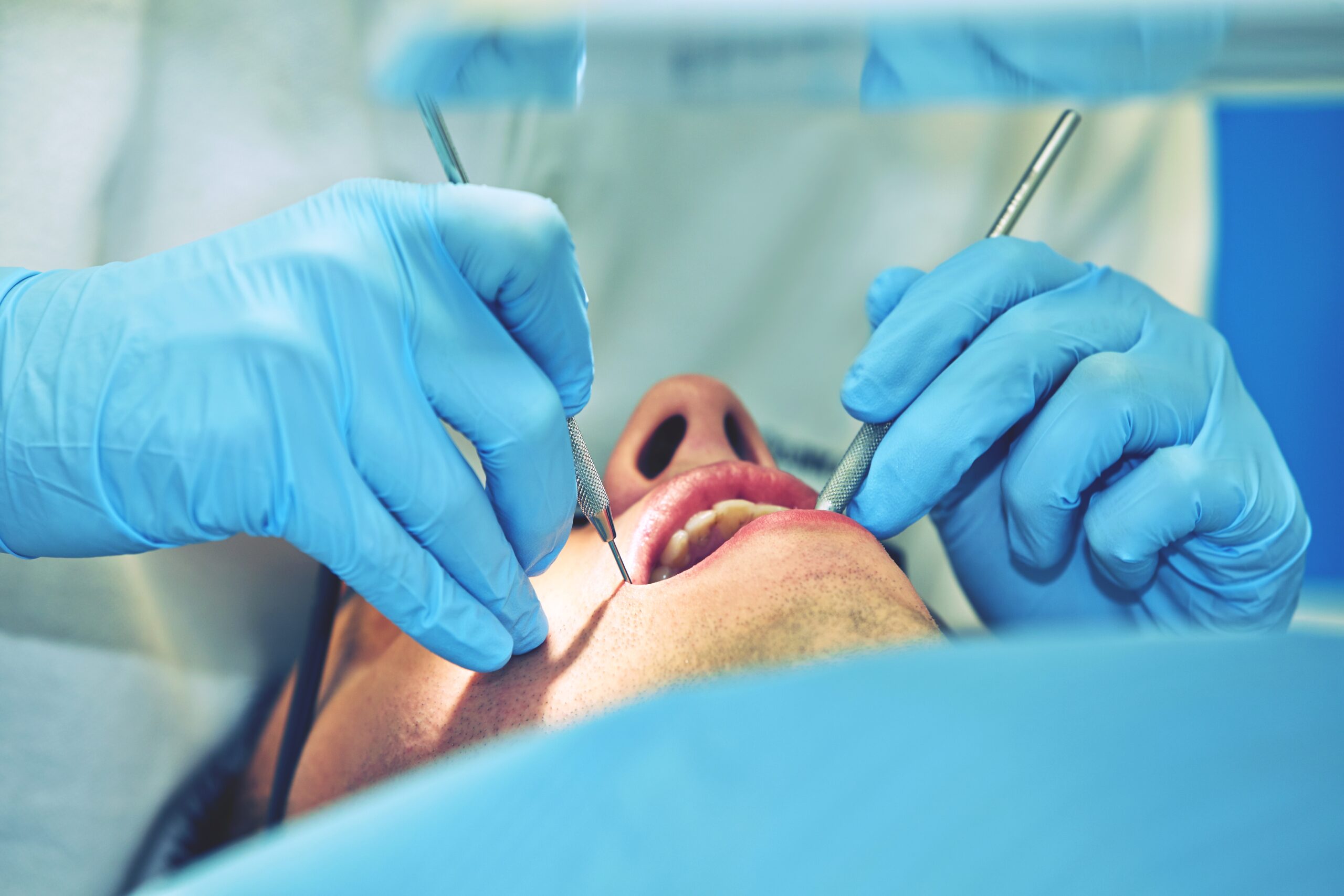 Tooth extraction care at Comprehensive Family Dentistry