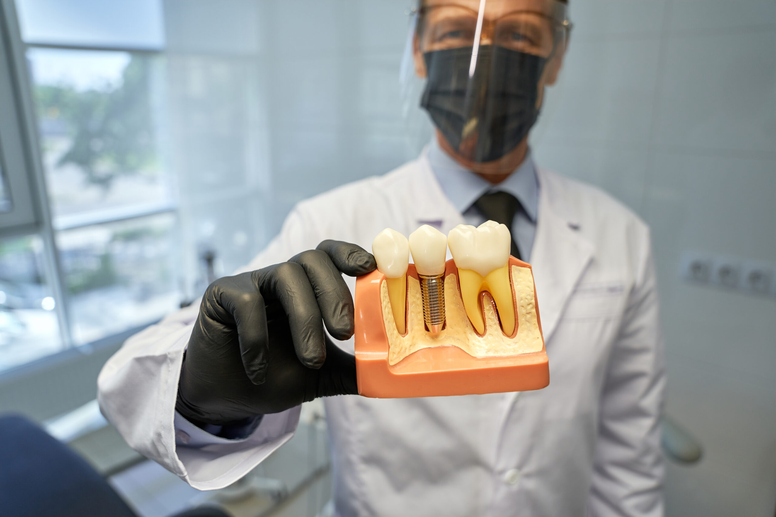 Dental implants and tooth replacement