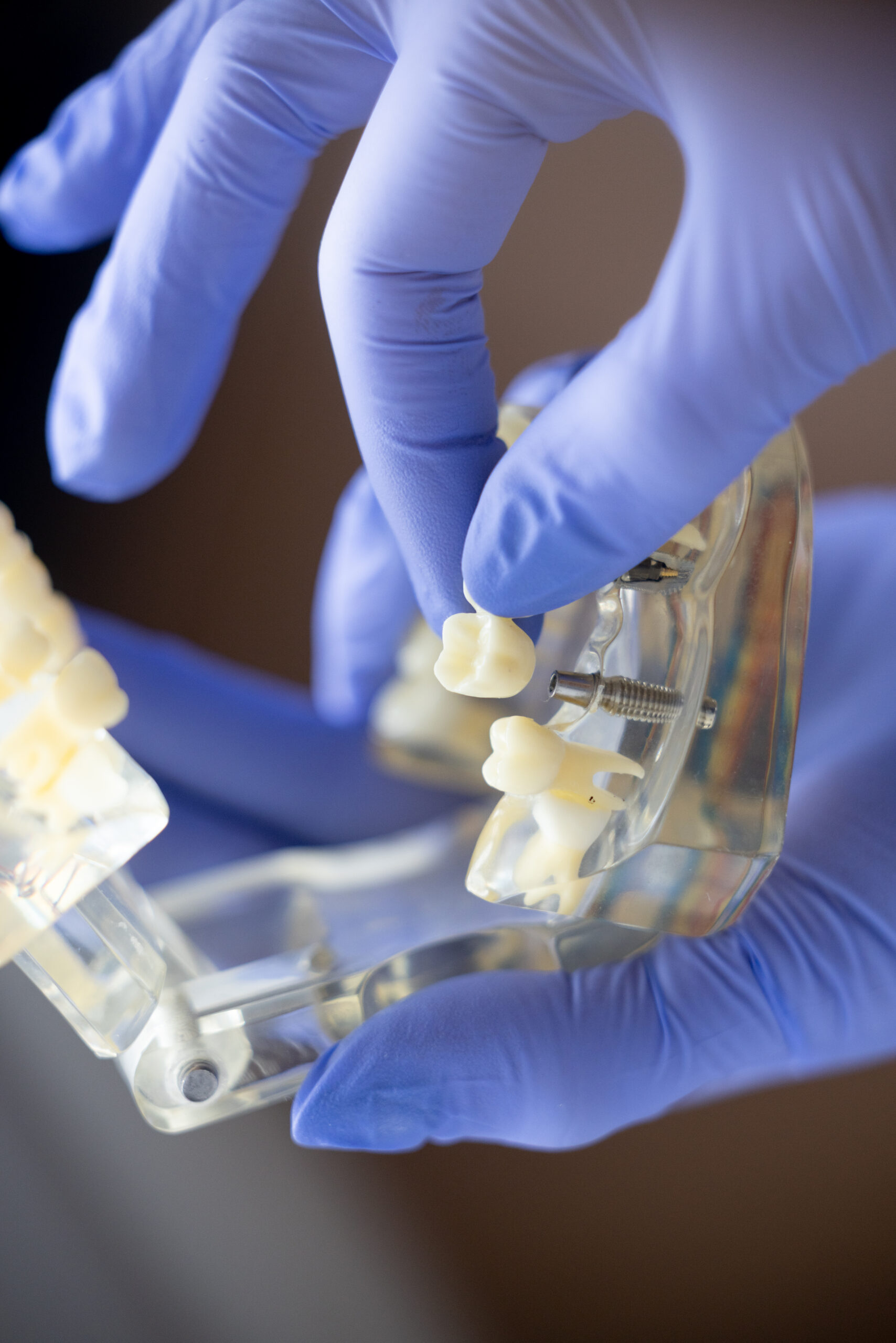 Dental implant care at Comprehensive Family Dentistry