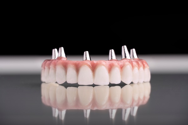 Implant-supported dentures