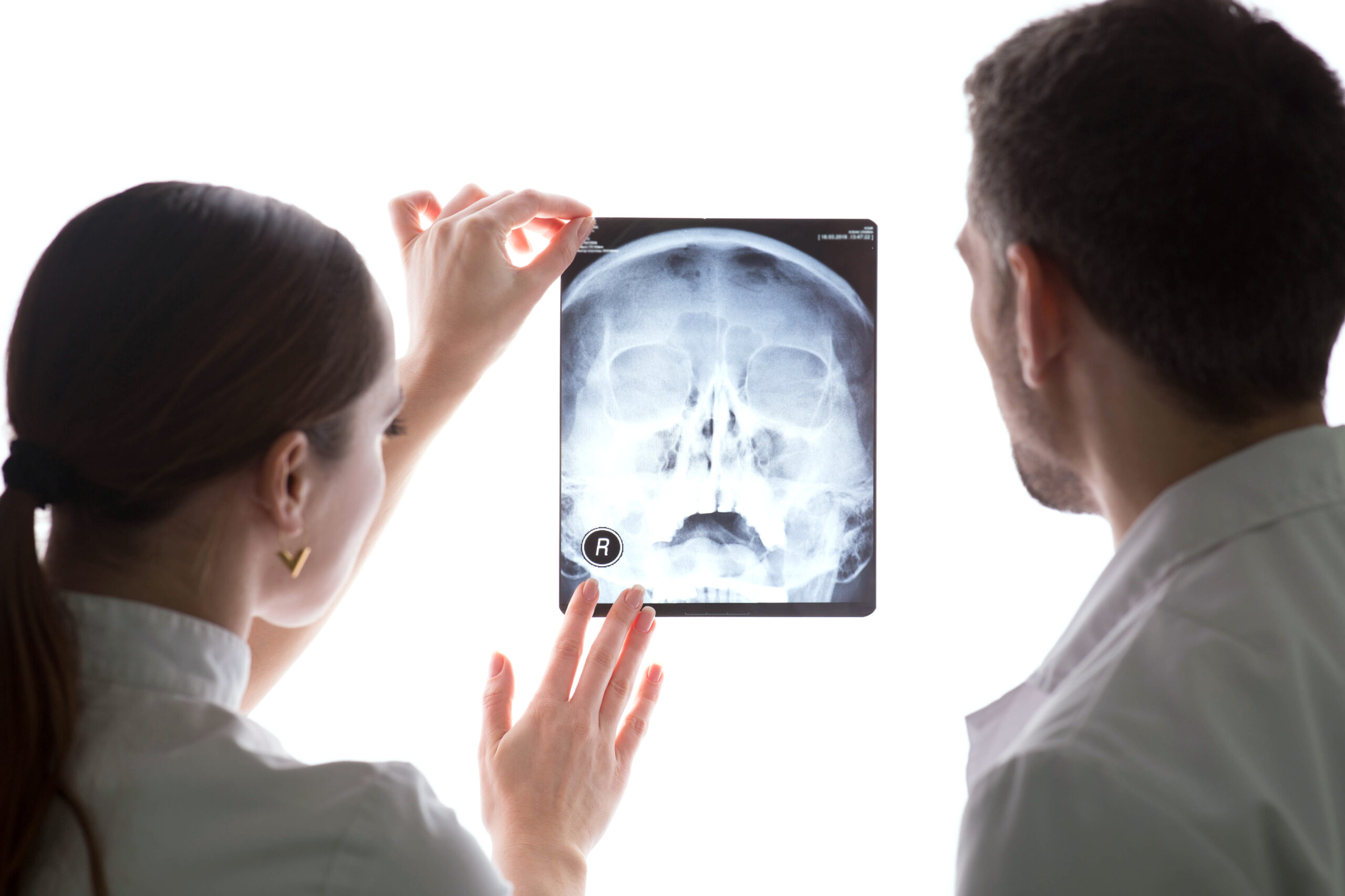 Medical professionals reviewing a skull X-ray for airway and jaw evaluation