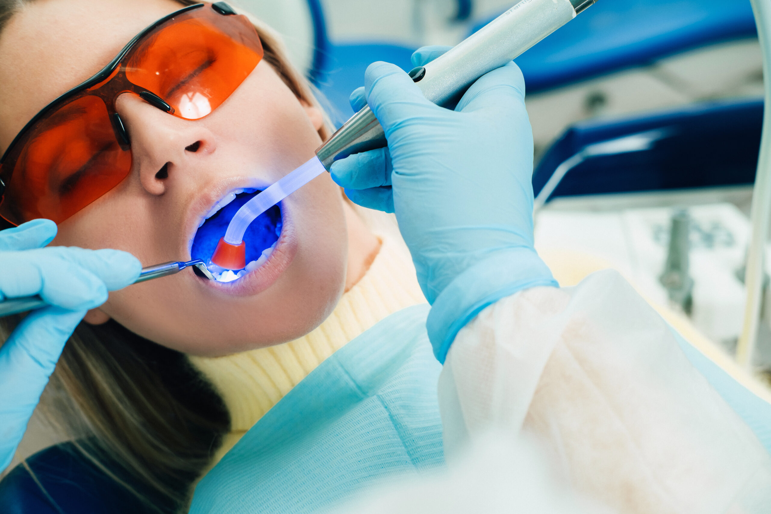 In-office professional teeth whitening