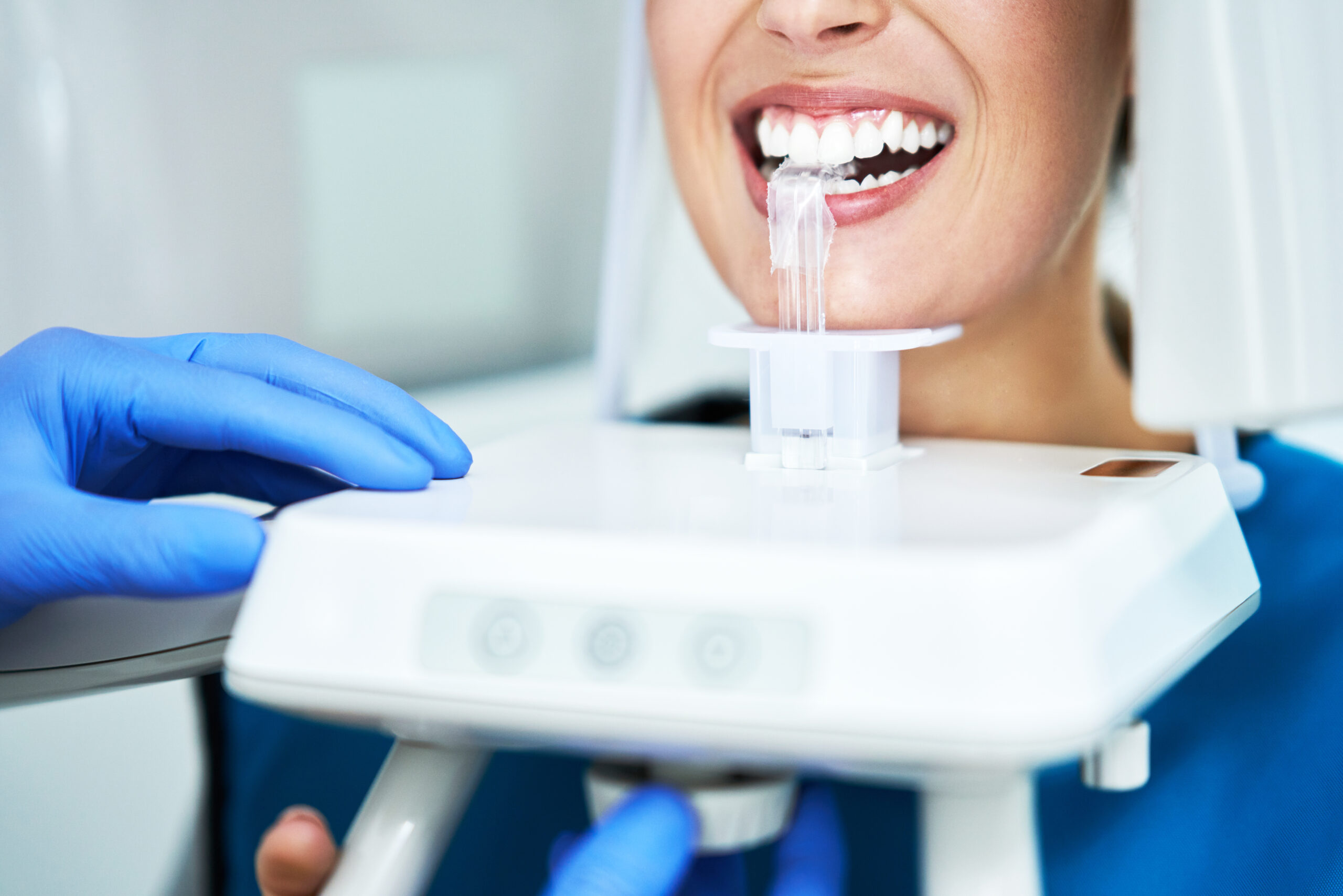 Evaluation of existing dental restorations before whitening