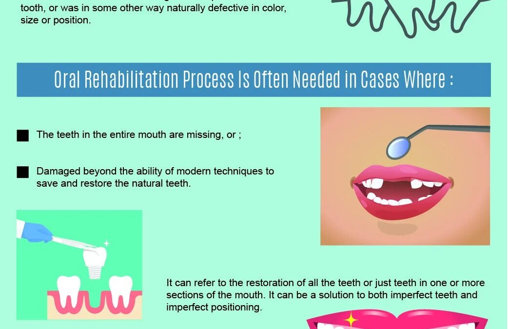 When Do You Need A Oral Rehabilitation- Infographic