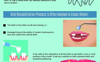 When Do You Need A Oral Rehabilitation- Infographic