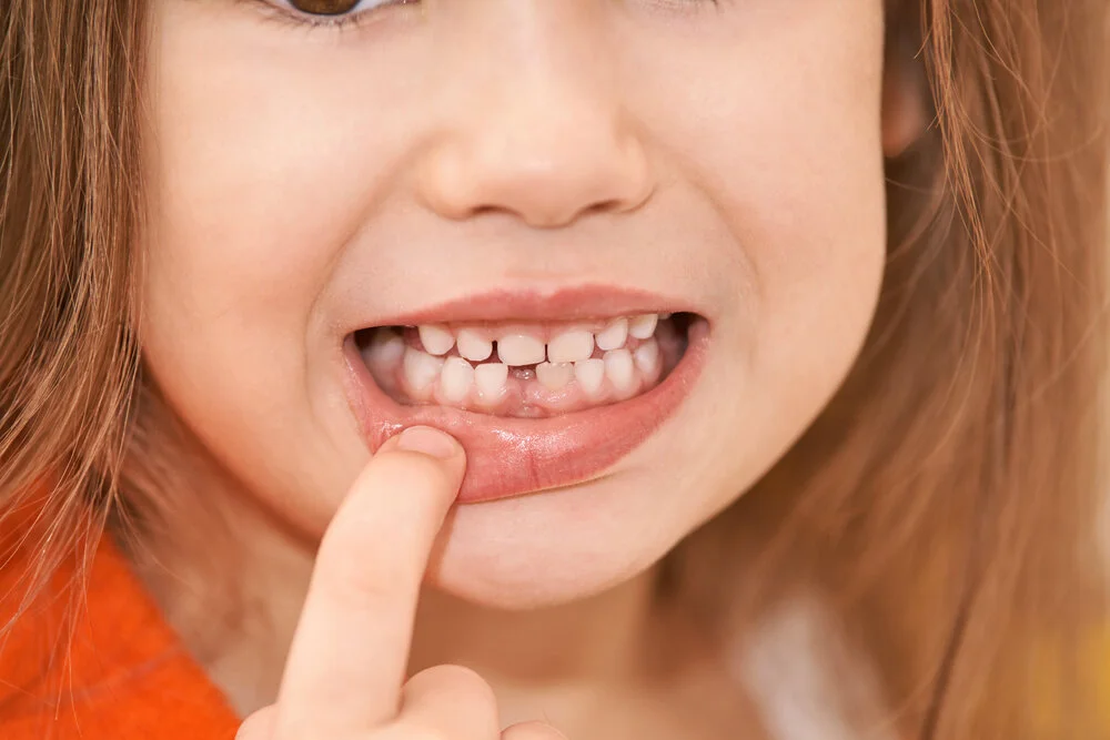 Dentist consultation for small teeth treatment