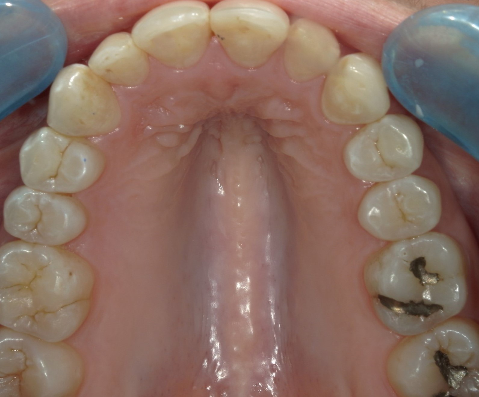 Orthodontics smile after treatment