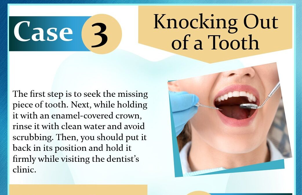 Stuck in The Void of Dental Emergency? Let These Remedies Help
