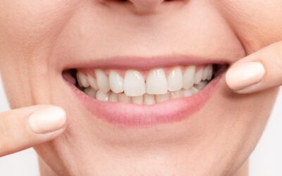 Ways in Which Cosmetic Dentists Can Renew Your Smile