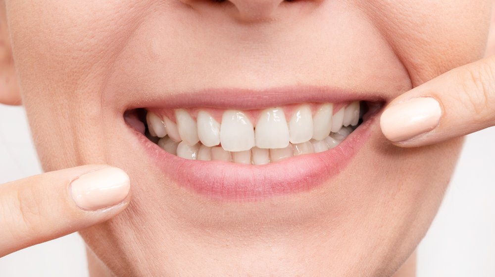Close-up of a healthy smile for cosmetic dentistry