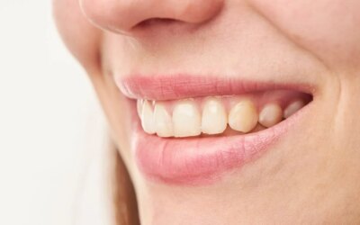 3 Recent Advancements in Cosmetic Dentistry that Blew Over
