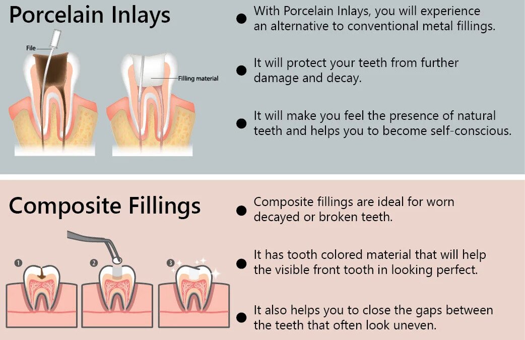 Your Perfect Cosmetic Dentistry Procedure