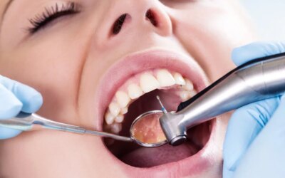 The Most Common Dental Procedures