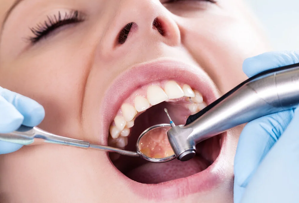 The Most Common Dental Procedures