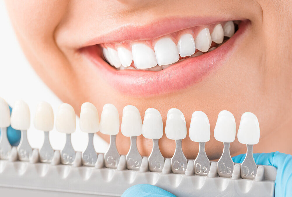 The Best Way to Find the Right Cosmetic Dentist