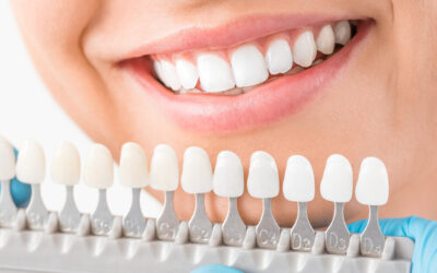 The Best Way to Find the Right Cosmetic Dentist