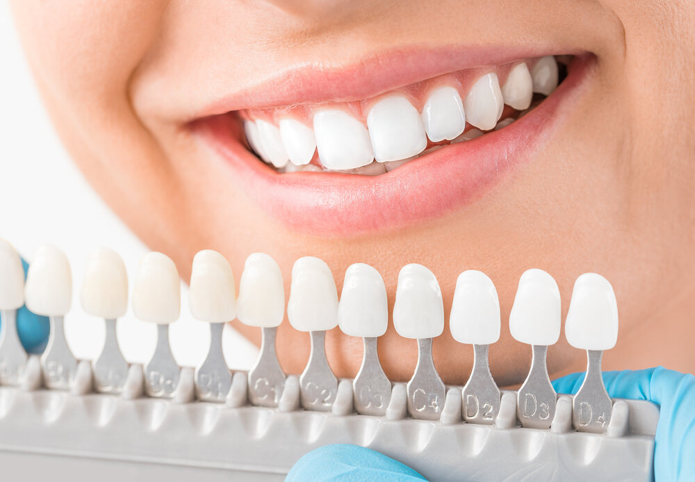 The Best Way to Find the Right Cosmetic Dentist
