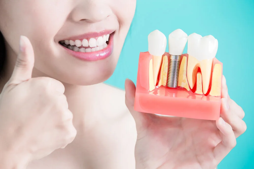 Various Reasons Why You Should Choose Dental Implants for You
