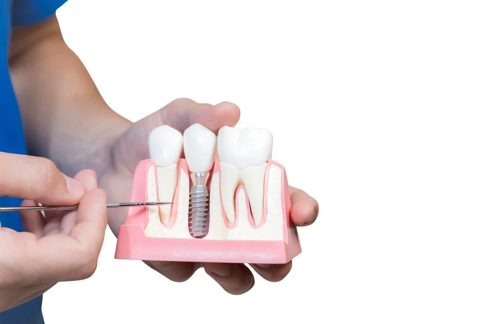 Dentist explaining different types of dental implants