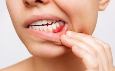 Preventing and Treating Gum Disease Are Now Easy