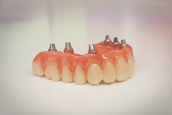 Placeholder image for implant-supported dentures