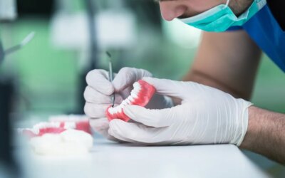 What You Need to Know About Permanent Dentures?