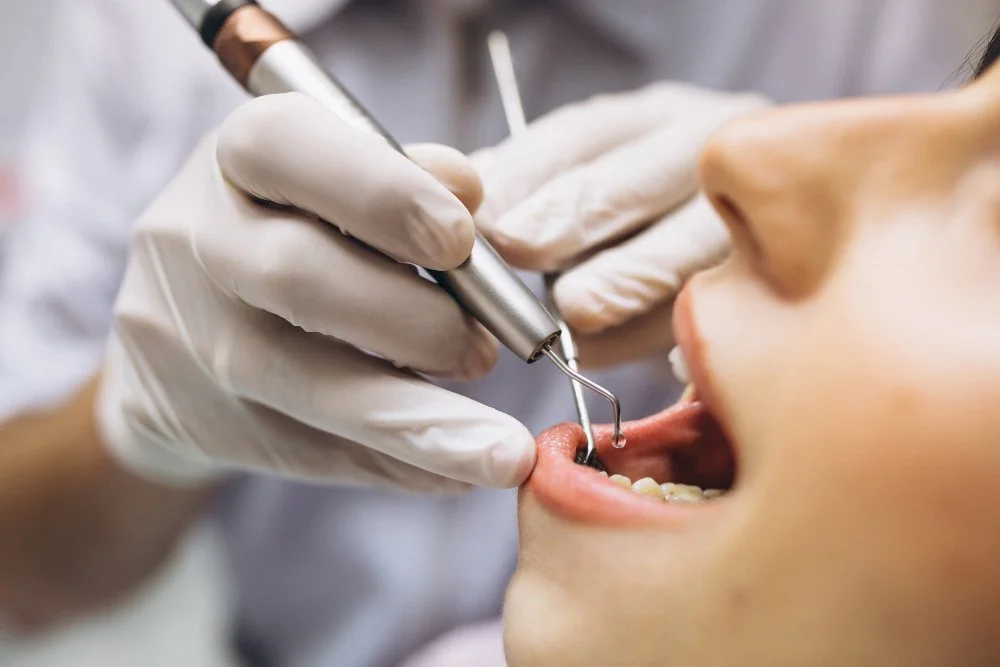 permanent dentures okc