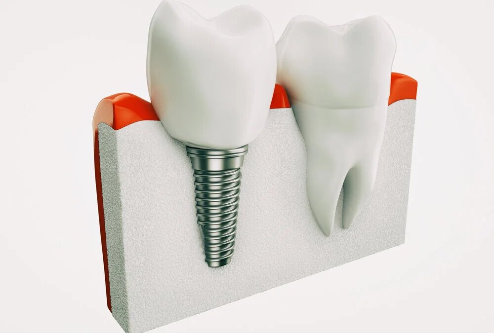 Knowing the Basic Difference between Permanent and Temporary Dentures