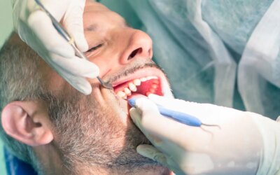 Root Canal Therapy and Its Benefits