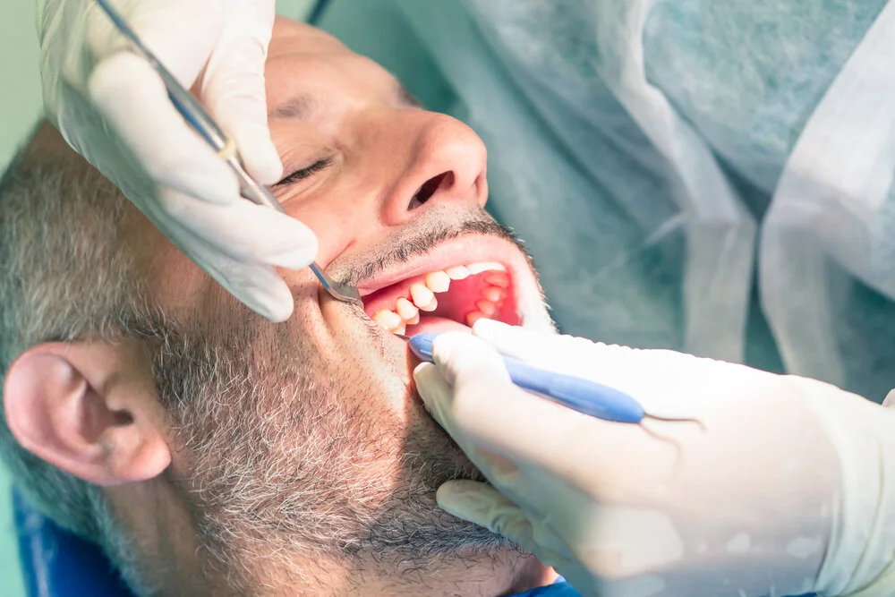 Root Canal Therapy and Its Benefits