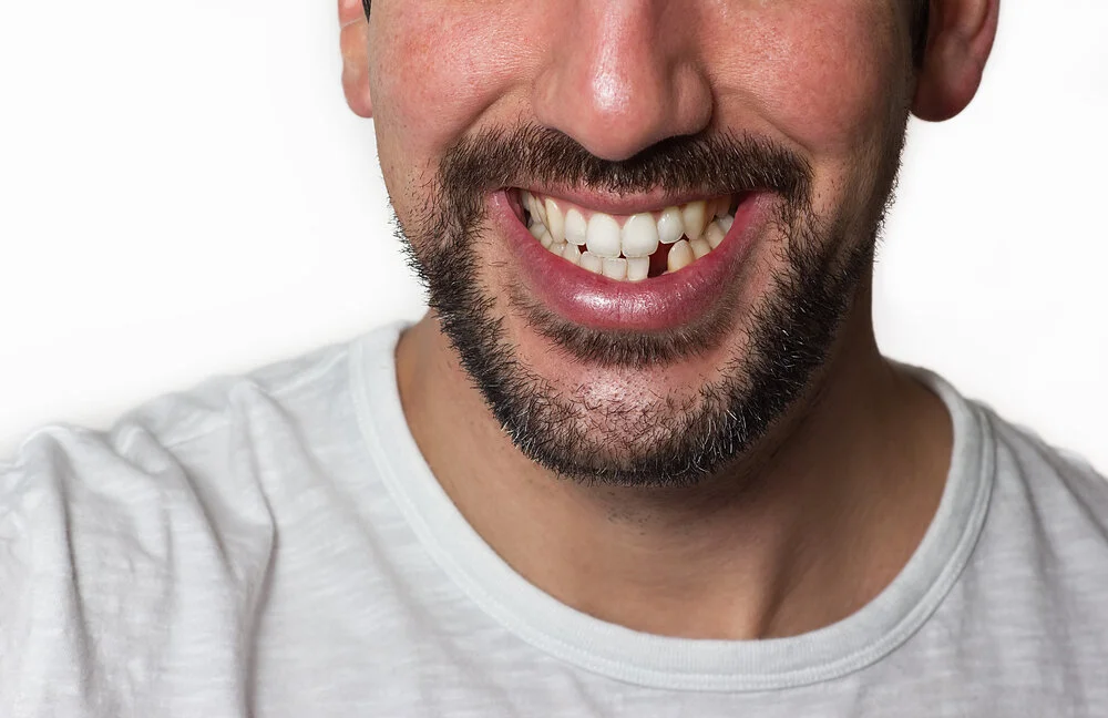 Patient discussing dental implant options